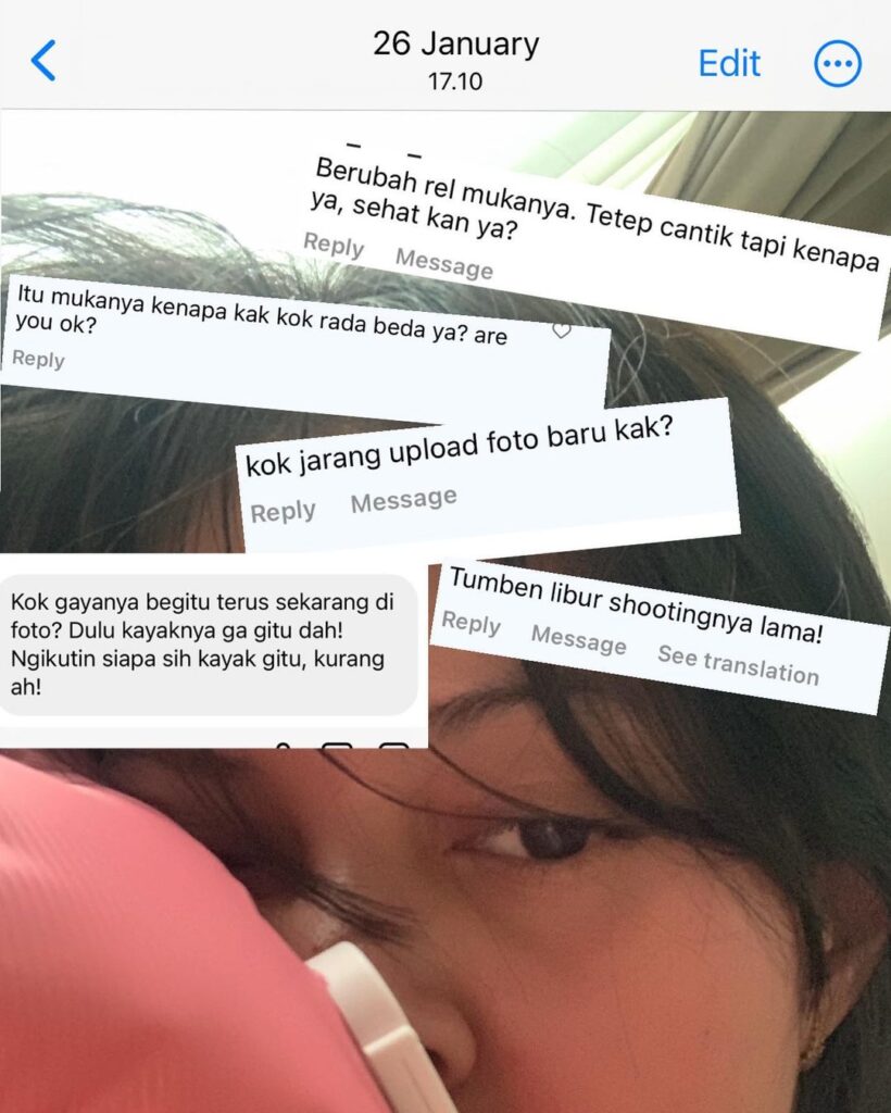 Wajah Seakan Lumpuh, Ini Penyebab Tumor Colli yang Diidap Aurelie Moremans